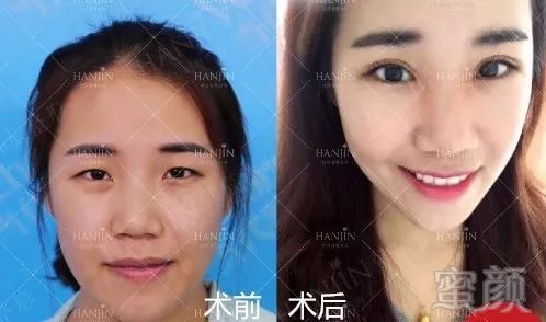 https://img.miyanlife.com/mnt/timg/180909/111GG3G-6.jpg