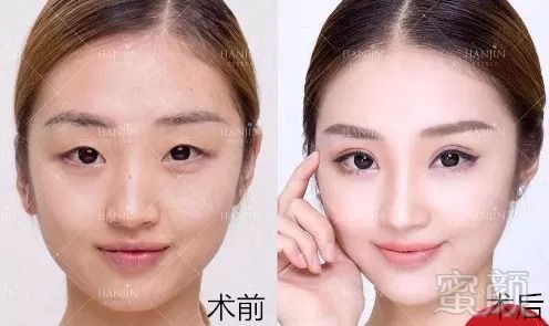 https://img.miyanlife.com/mnt/timg/180909/111GH549-7.jpg