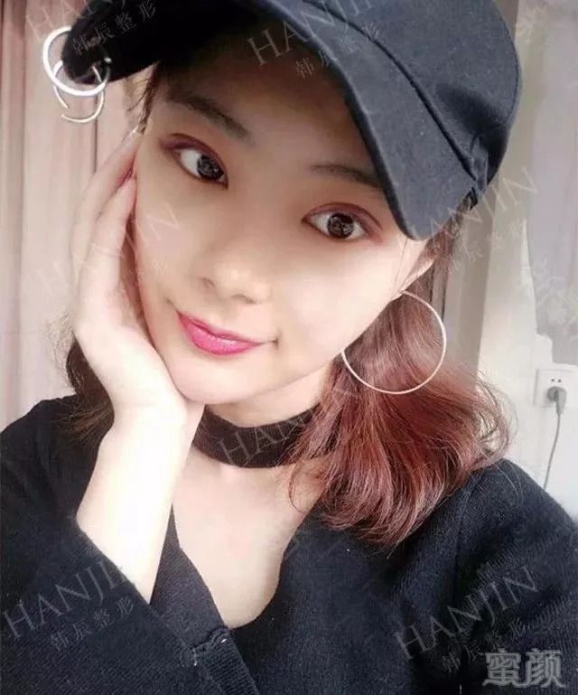 https://img.miyanlife.com/mnt/timg/180909/111GL2D-3.jpg