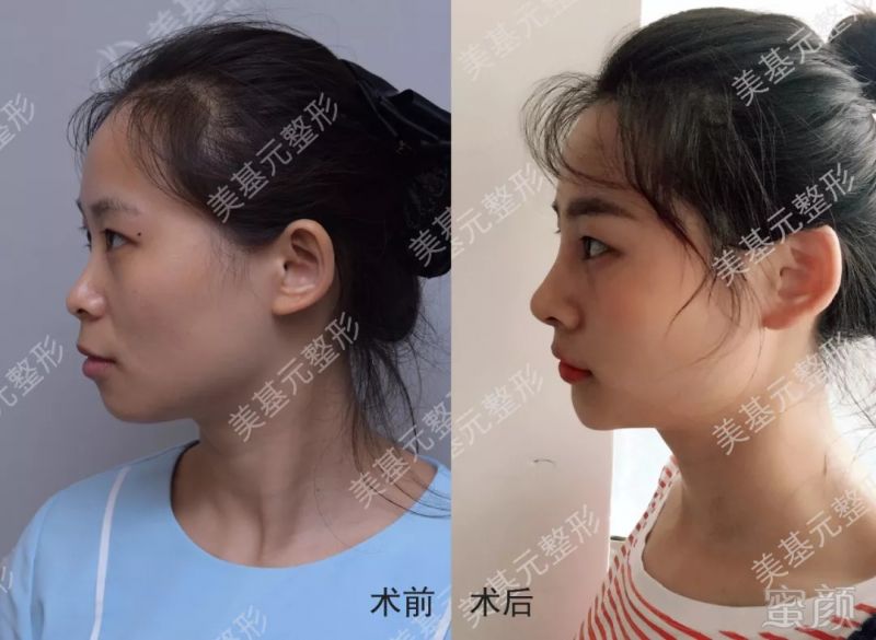 https://img.miyanlife.com/mnt/timg/180909/113K4K42-5.jpg