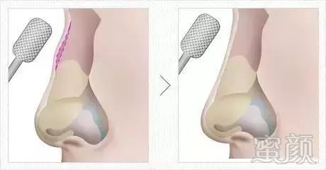 https://img.miyanlife.com/mnt/timg/180909/113K4O64-8.jpg