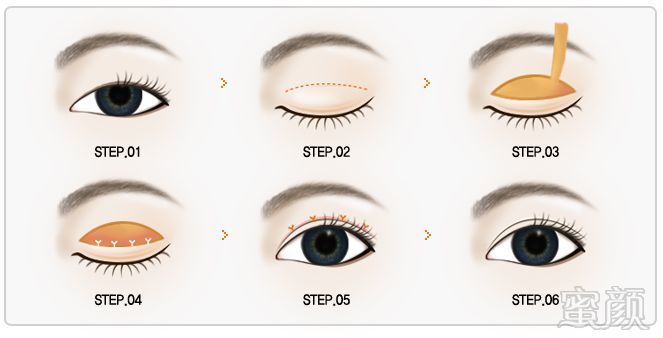 https://img.miyanlife.com/mnt/timg/180909/1143291931-11.jpg