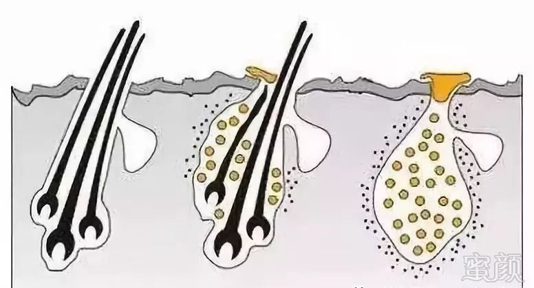 https://img.miyanlife.com/mnt/timg/180909/1149304522-13.jpg