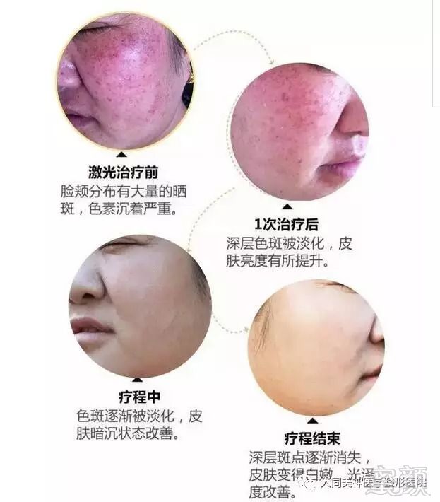 https://img.miyanlife.com/mnt/timg/180909/115233Db-3.jpg