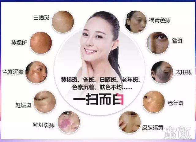 https://img.miyanlife.com/mnt/timg/180909/12010232R-1.jpg