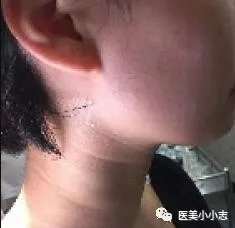 https://img.miyanlife.com/mnt/timg/180909/12051V296-0.jpg