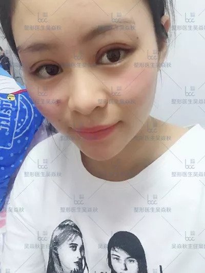 https://img.miyanlife.com/mnt/timg/180909/120I31505-5.jpg