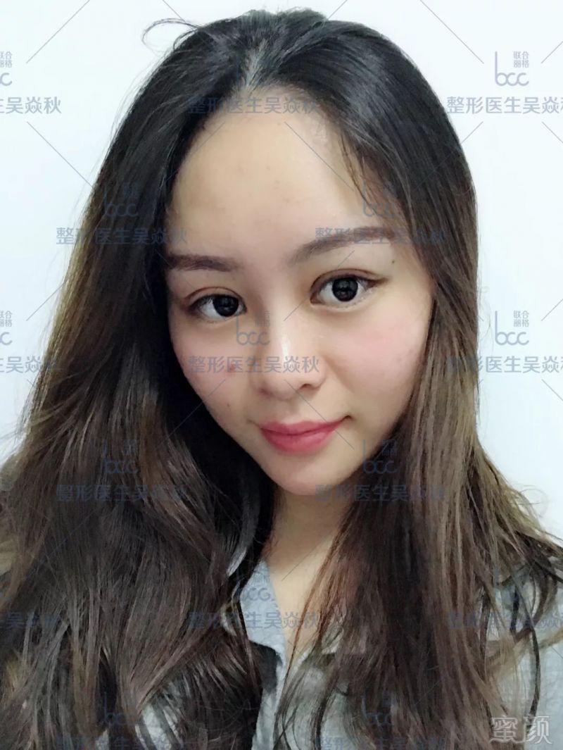https://img.miyanlife.com/mnt/timg/180909/120I342J-6.jpg