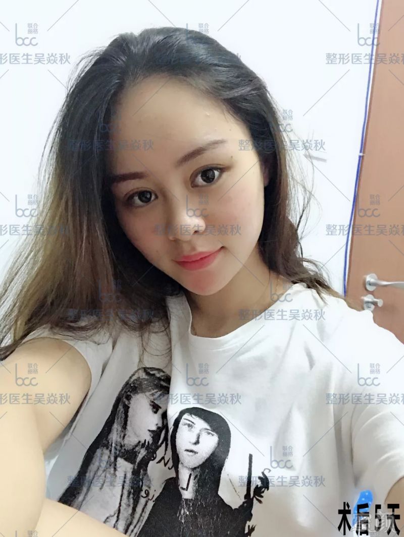 https://img.miyanlife.com/mnt/timg/180909/120I41359-7.jpg