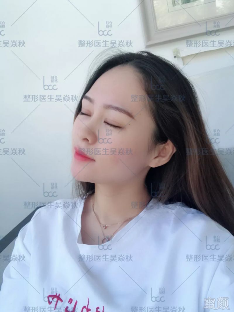 https://img.miyanlife.com/mnt/timg/180909/120IA5I-12.jpg
