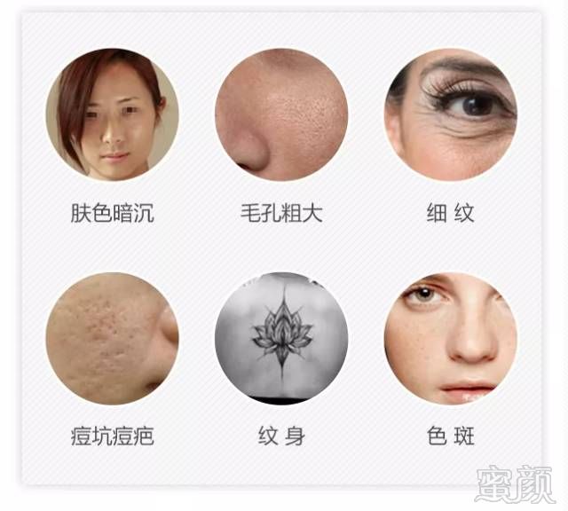 https://img.miyanlife.com/mnt/timg/180909/1212145945-0.jpg