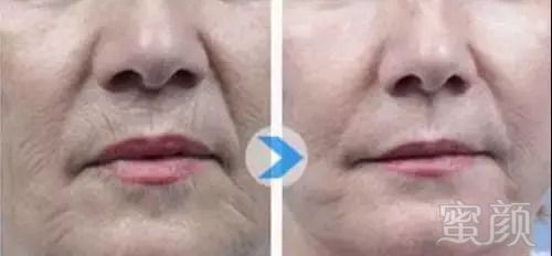 https://img.miyanlife.com/mnt/timg/180909/121T45520-6.jpg