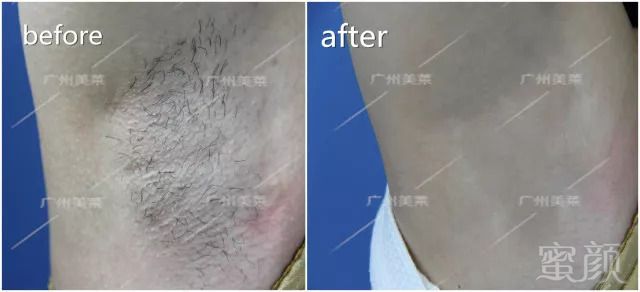https://img.miyanlife.com/mnt/timg/180909/12344152X-7.jpg