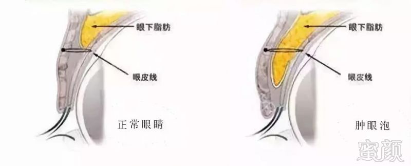 https://img.miyanlife.com/mnt/timg/180909/12512250L-4.jpg
