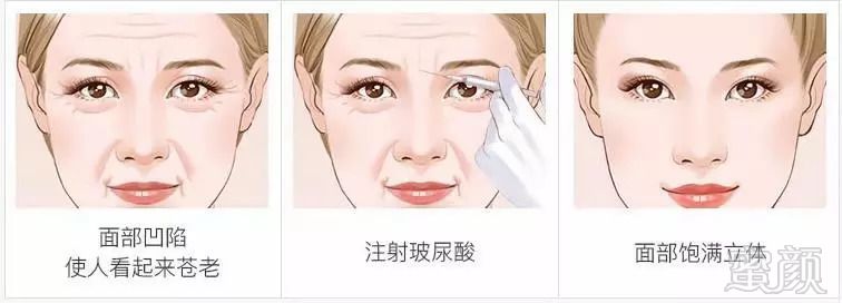 https://img.miyanlife.com/mnt/timg/180909/13061634S-5.jpg
