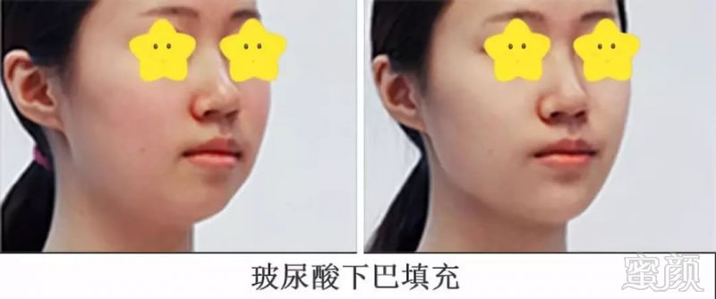 https://img.miyanlife.com/mnt/timg/180909/13061C351-6.jpg