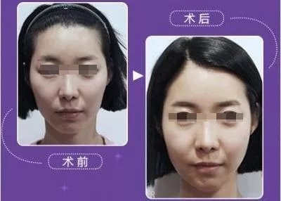https://img.miyanlife.com/mnt/timg/180909/13061I308-11.jpg