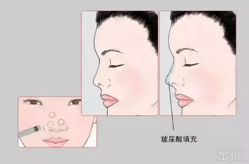 https://img.miyanlife.com/mnt/timg/180909/13061I931-9.jpg