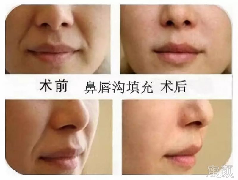https://img.miyanlife.com/mnt/timg/180909/13061I948-8.jpg