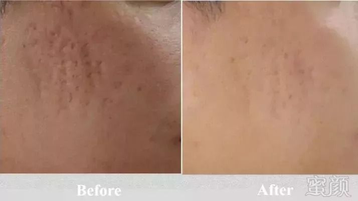 https://img.miyanlife.com/mnt/timg/180909/1322504932-7.jpg