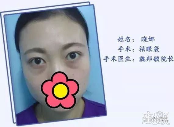 https://img.miyanlife.com/mnt/timg/180909/134052HE-0.jpg