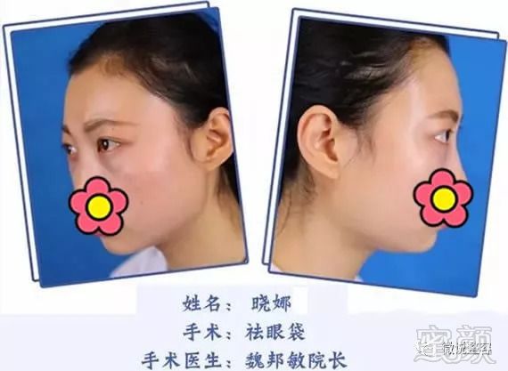 https://img.miyanlife.com/mnt/timg/180909/1340533036-3.jpg