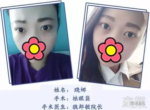 https://img.miyanlife.com/mnt/timg/180909/1340533060-4.jpg