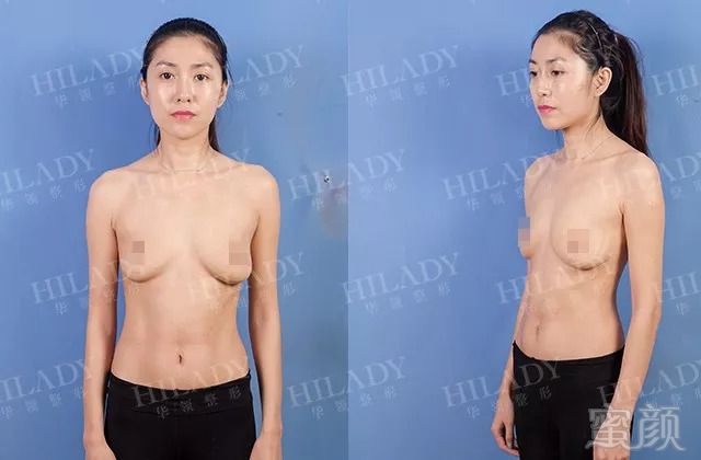 https://img.miyanlife.com/mnt/timg/180910/111R422V-4.jpg