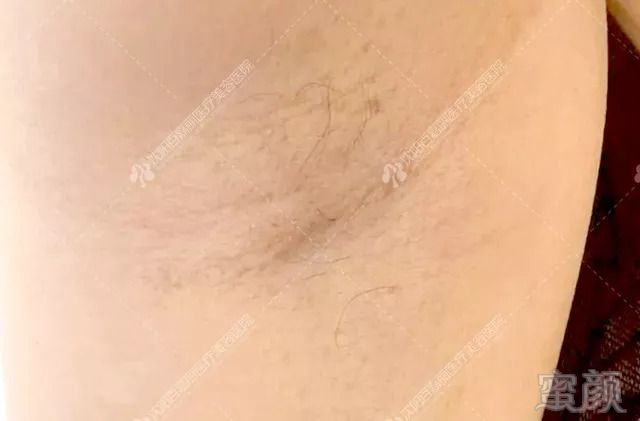 https://img.miyanlife.com/mnt/timg/180910/111T41302-5.jpg