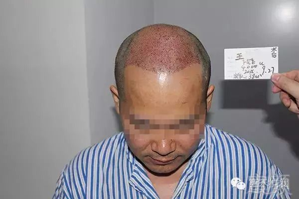 https://img.miyanlife.com/mnt/timg/180910/11220V428-7.jpg