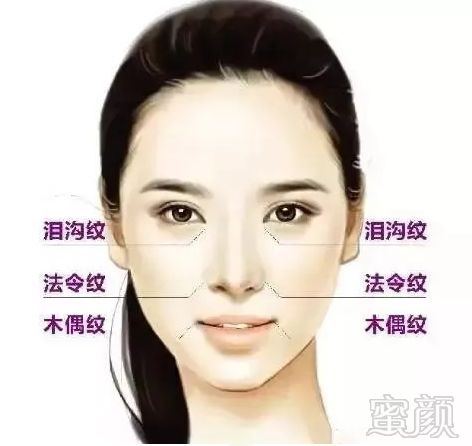 https://img.miyanlife.com/mnt/timg/180910/11522K125-3.jpg