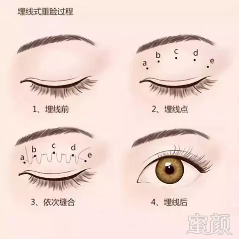 https://img.miyanlife.com/mnt/timg/180910/115G44019-2.jpg