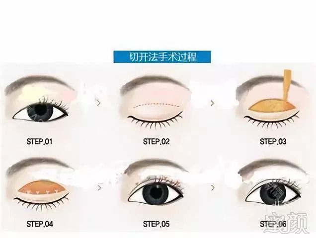 https://img.miyanlife.com/mnt/timg/180910/115G45949-1.jpg