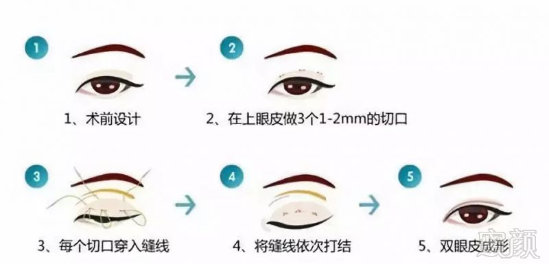 https://img.miyanlife.com/mnt/timg/180910/115G46224-3.jpg
