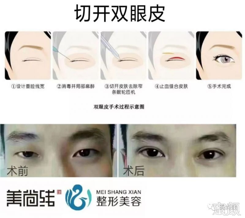 https://img.miyanlife.com/mnt/timg/180910/115R13Q1-0.jpg