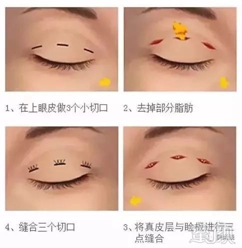 https://img.miyanlife.com/mnt/timg/180910/115R145L-2.jpg