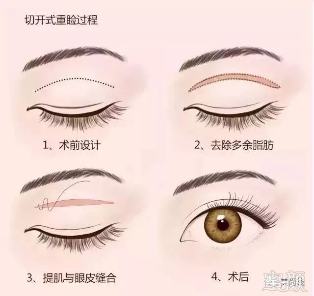 https://img.miyanlife.com/mnt/timg/180910/115R152V-1.jpg