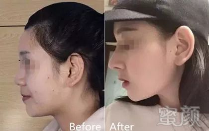 https://img.miyanlife.com/mnt/timg/180910/1204155300-3.jpg