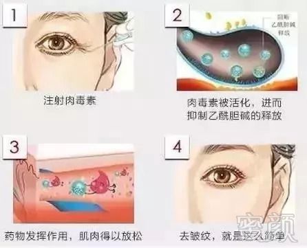 https://img.miyanlife.com/mnt/timg/180910/12053C944-9.jpg