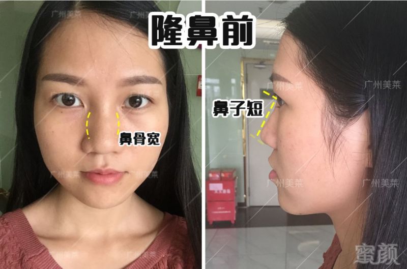 https://img.miyanlife.com/mnt/timg/180910/120J61V2-3.jpg