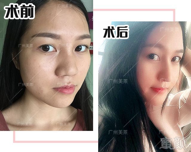 https://img.miyanlife.com/mnt/timg/180910/120J62413-0.jpg