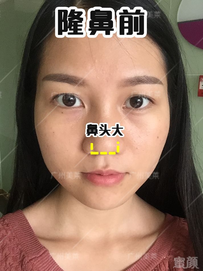 https://img.miyanlife.com/mnt/timg/180910/120JB2a-2.jpg