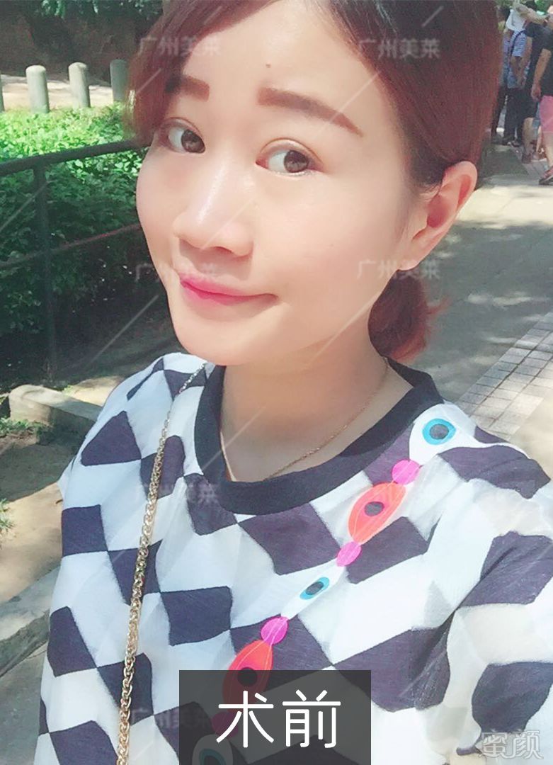 https://img.miyanlife.com/mnt/timg/180910/120JH5V-5.jpg