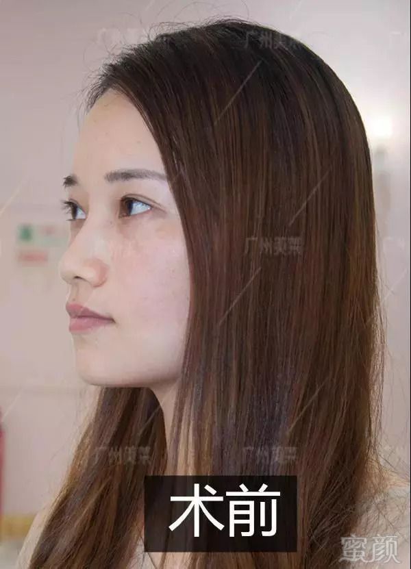 https://img.miyanlife.com/mnt/timg/180910/120JI623-4.jpg