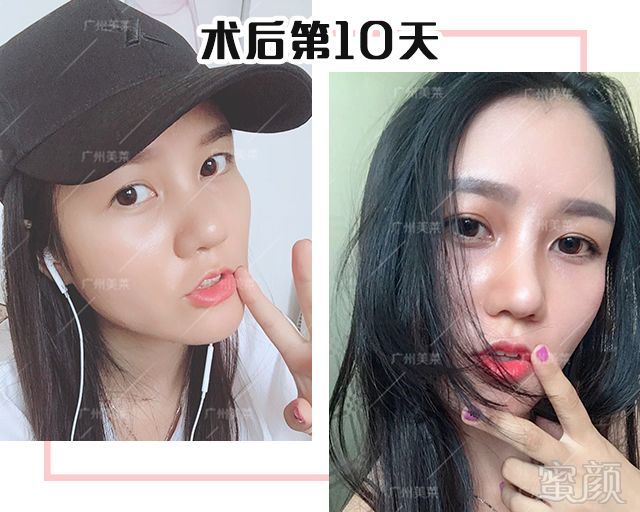https://img.miyanlife.com/mnt/timg/180910/120JLC8-10.jpg