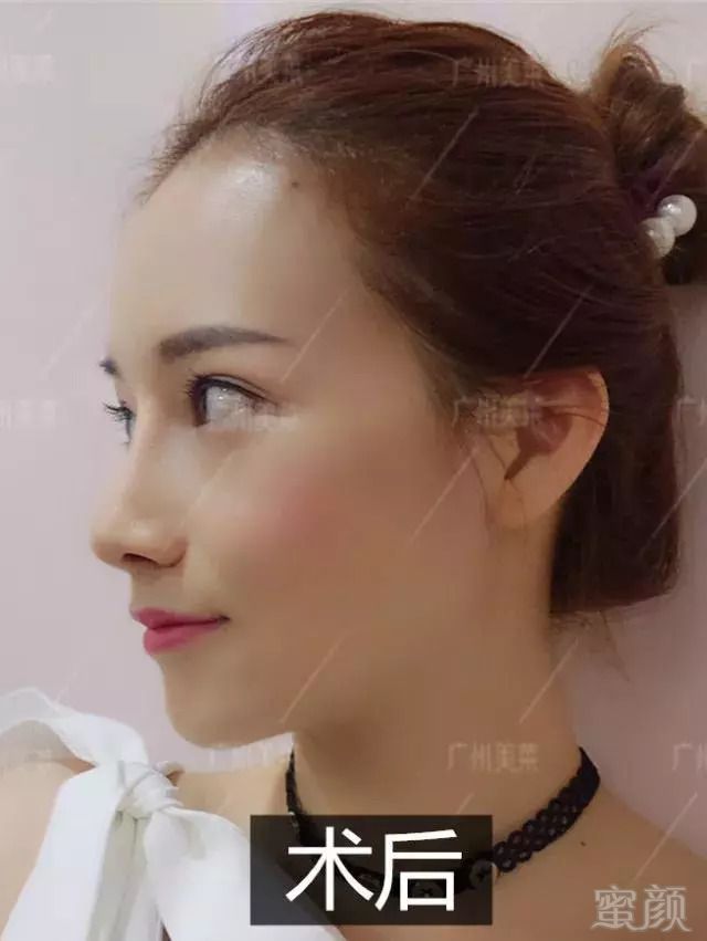https://img.miyanlife.com/mnt/timg/180910/120JMG3-7.jpg