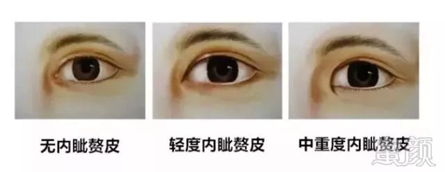 https://img.miyanlife.com/mnt/timg/180910/120R01b1-3.jpg