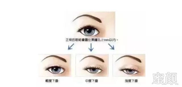 https://img.miyanlife.com/mnt/timg/180910/120R03Q4-6.jpg
