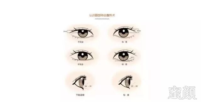 https://img.miyanlife.com/mnt/timg/180910/120R15628-7.jpg