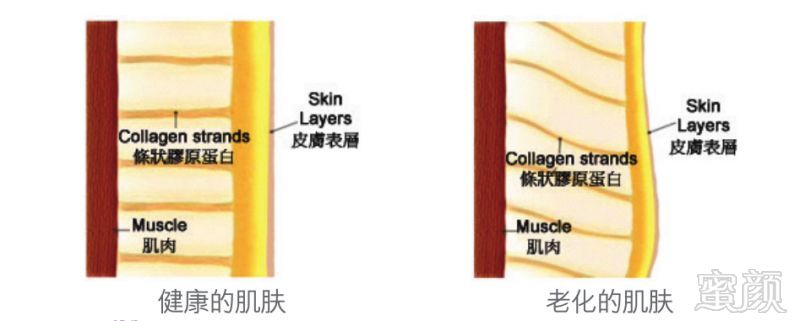 https://img.miyanlife.com/mnt/timg/180910/1215062126-11.jpg